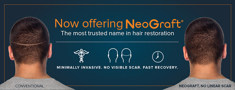 Now Offering NeoGraft